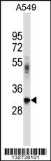 BNIP2 Antibody