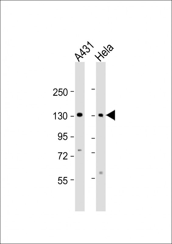 ZBTB11 Antibody