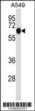ALPPL2 Antibody
