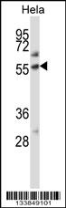 ALPP Antibody