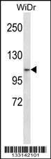 ZNF836 Antibody