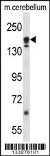 ATG2A Antibody