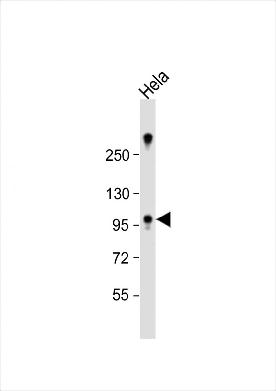 ZCCHC14 Antibody