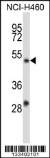 YY2 Antibody