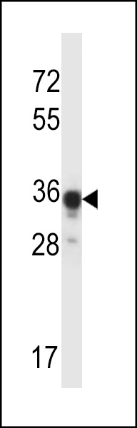 ABHD4 Antibody
