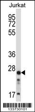ARHGDIB Antibody