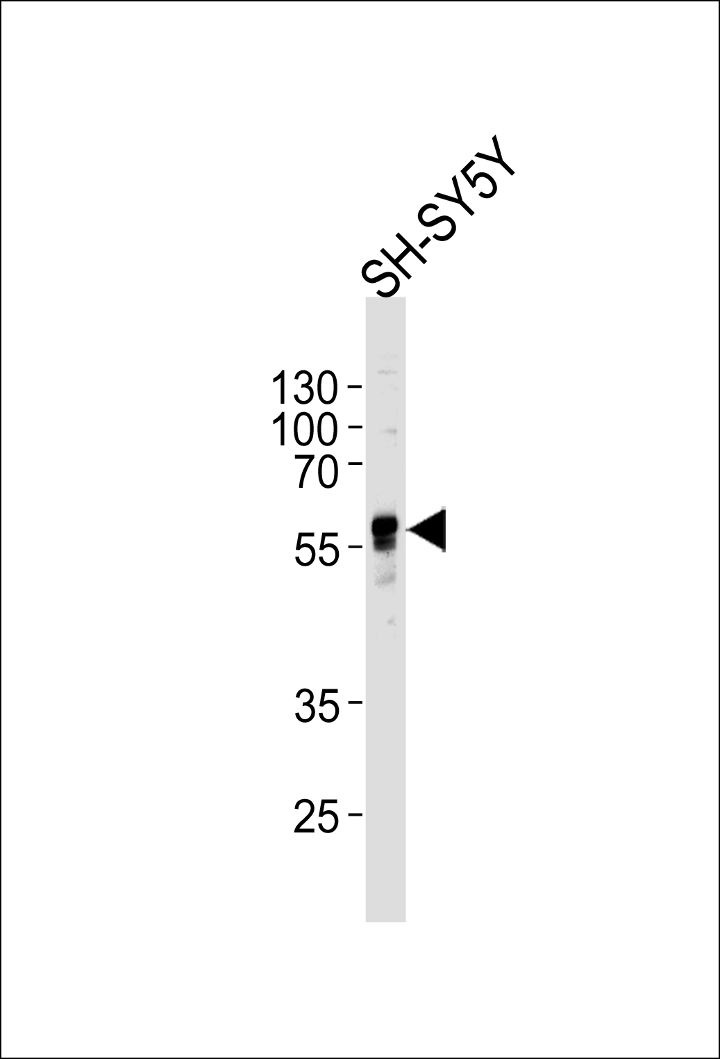ABHD3 Antibody