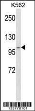ADAMTS5 Antibody