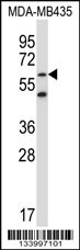 ZNF479 Antibody