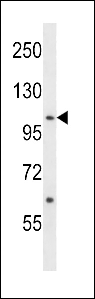 ACK1 Antibody