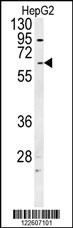 UGT1A1 Antibody