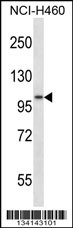 ADAM8 Antibody