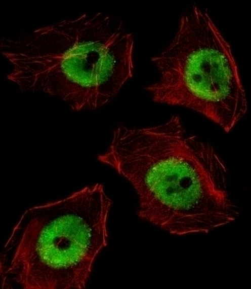 UBP1 Antibody