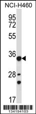 AKR1B10 Antibody