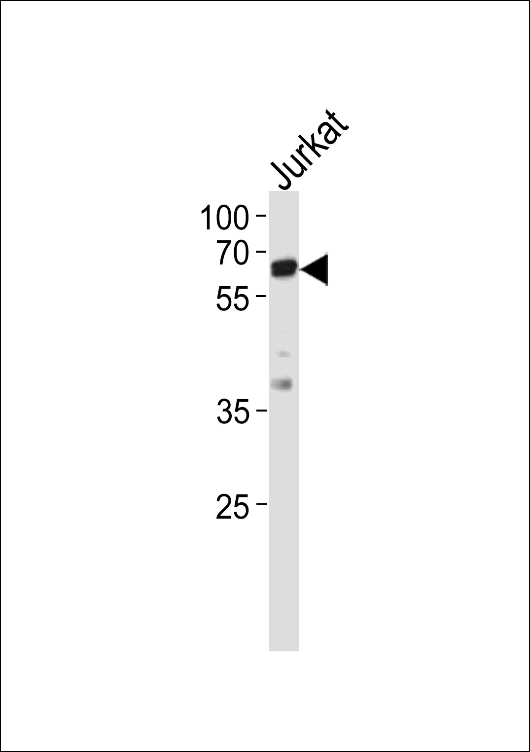 ZAP70 Antibody