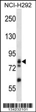 ADD3 Antibody