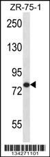 AGGF1 Antibody