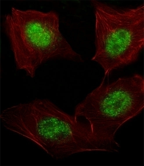 ARNT Antibody