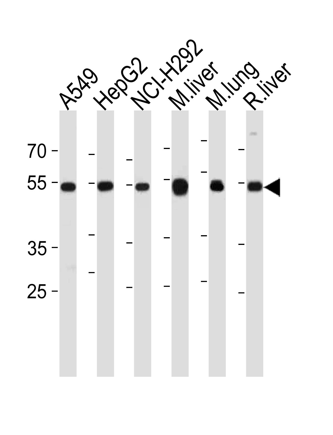 ALDH2 Antibody