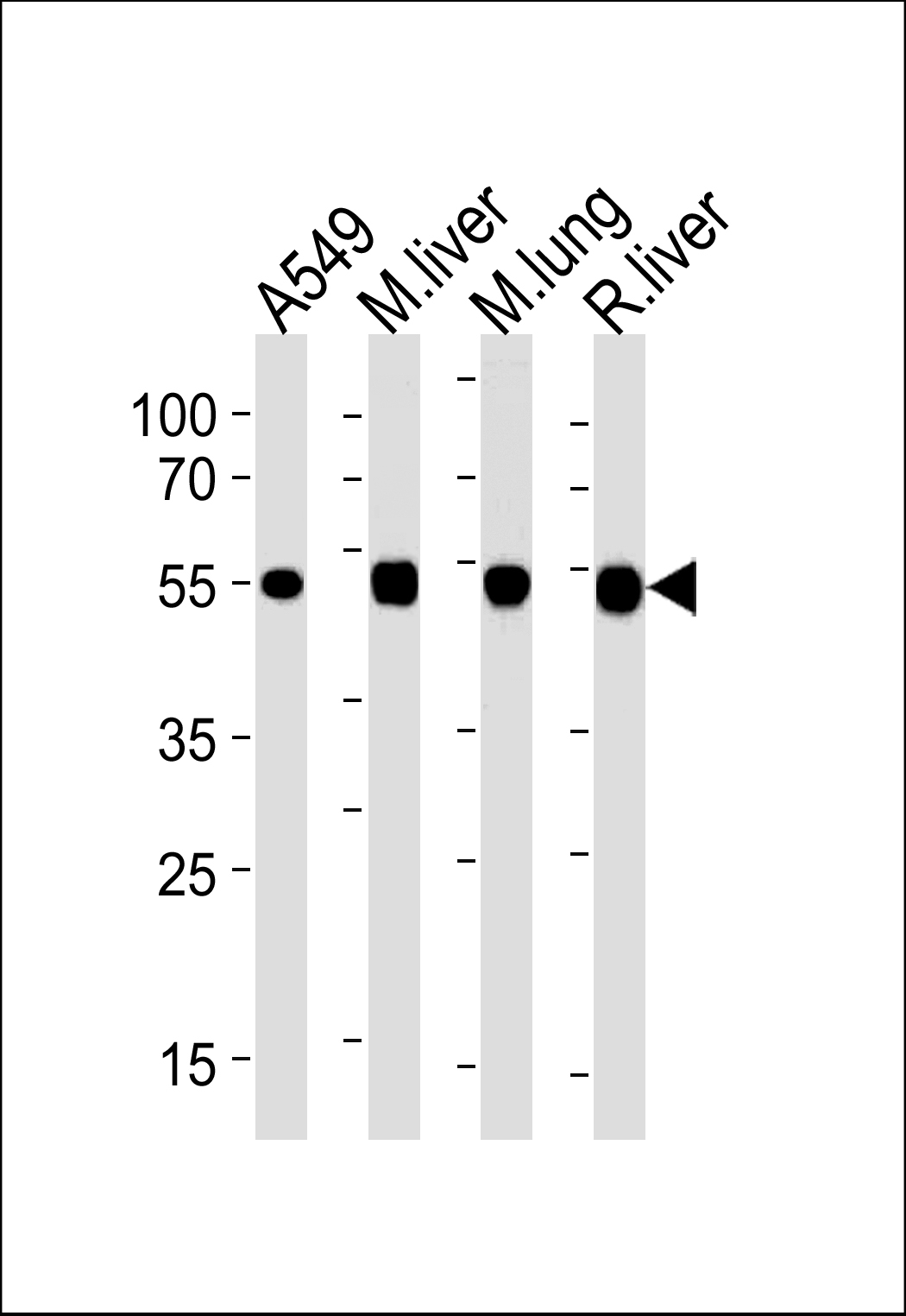 ALDH2 Antibody