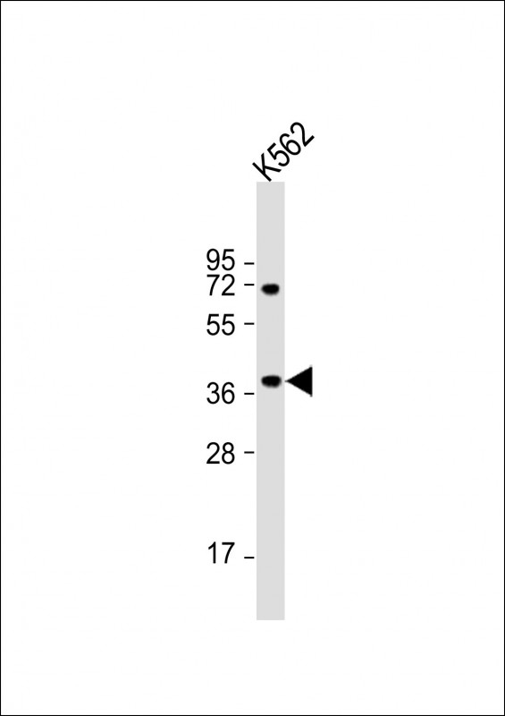 BLVRA Antibody
