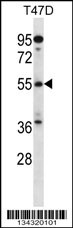 ARFGAP3 Antibody