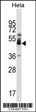ZNF174 Antibody