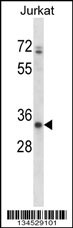 ART3 Antibody