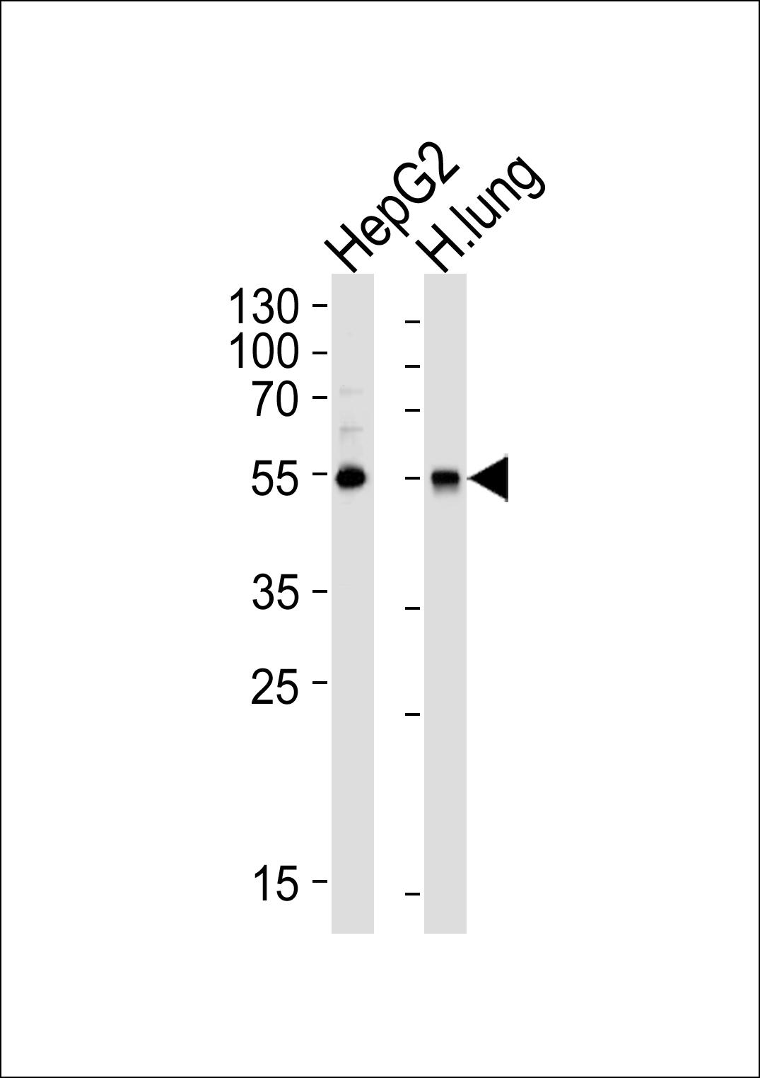 ALDH1A1 Antibody
