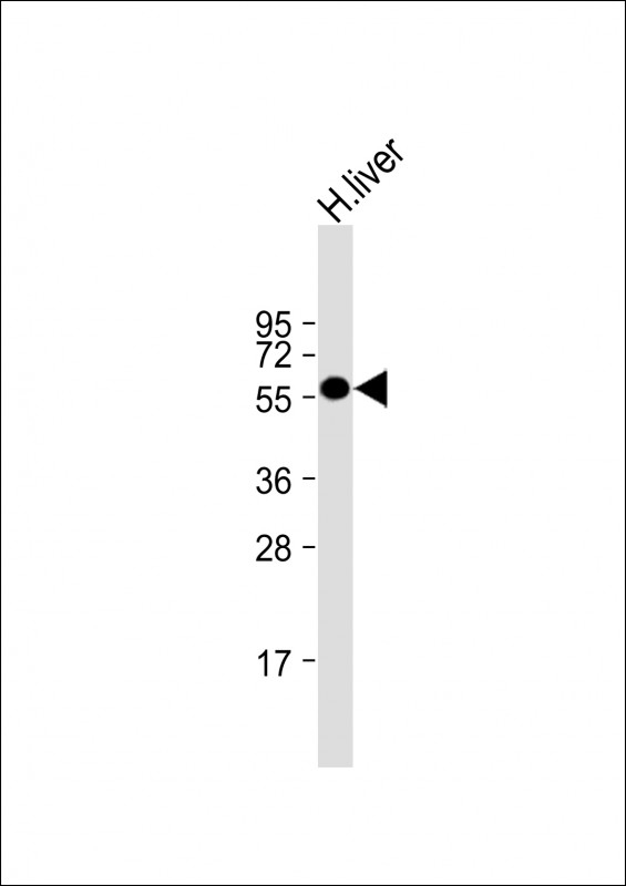 ALDH6A1 Antibody