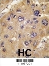 ALDH6A1 Antibody