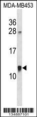 ACBD7 Antibody