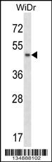 ANKS4B Antibody