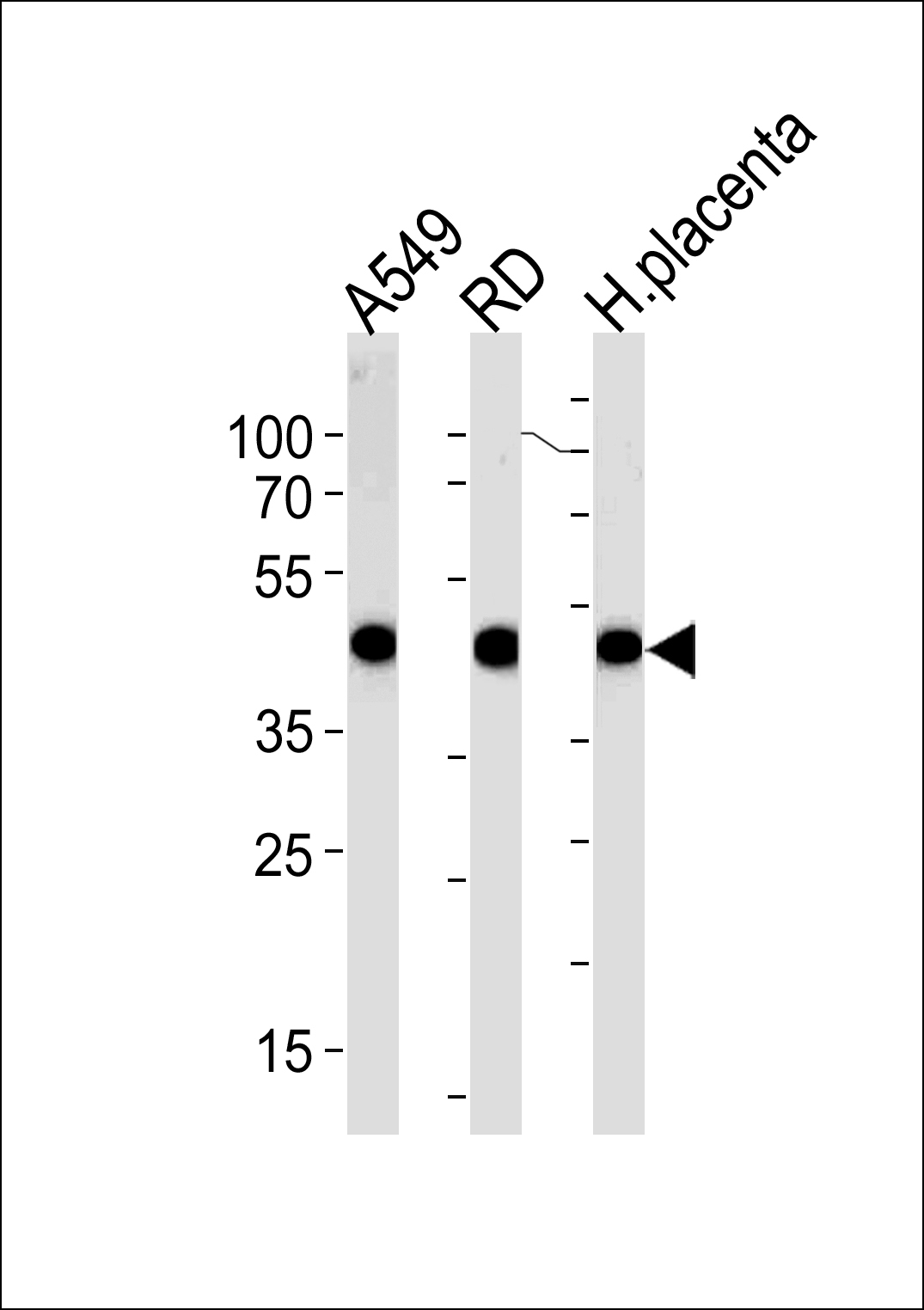 ACTA1/Alpha-actin Antibody