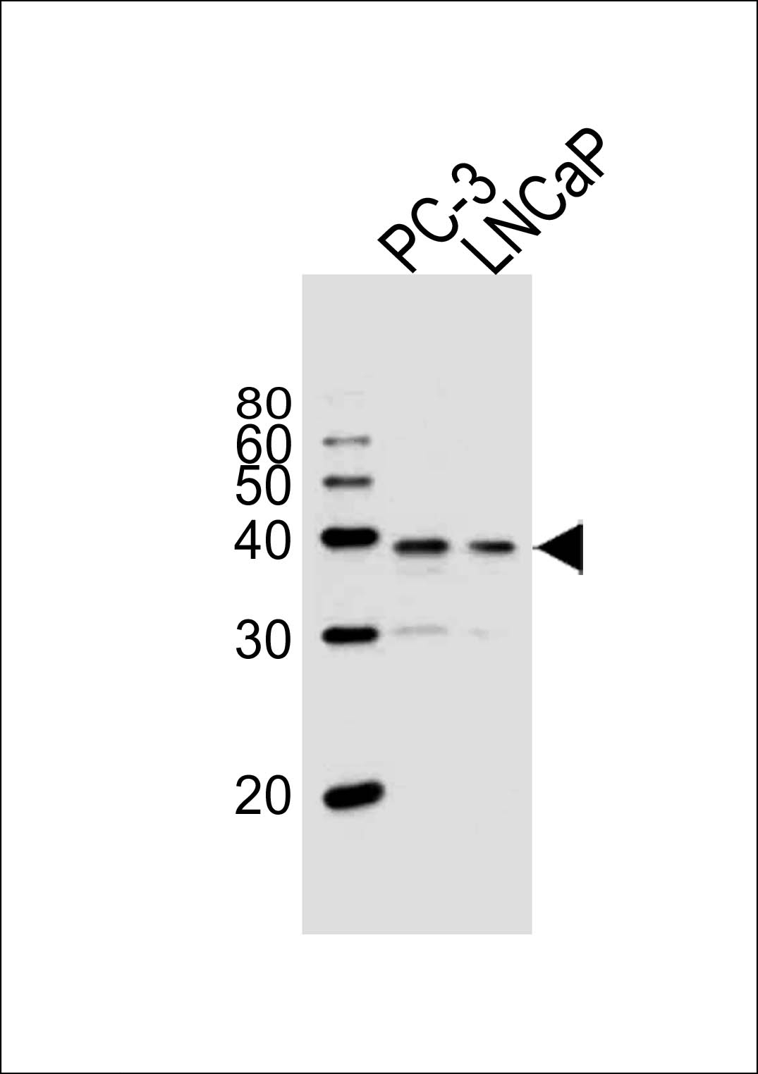 VDR Antibody