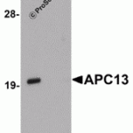 Western blot analysis of PIAS4 in rat brain tissue lysate with PIAS4 antibody at 1 μg/mL in (A) the absence and (B) the presence of blocking peptide.