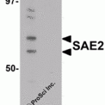 Western blot analysis of SAE2 in 293 cell lysate with SAE2 antibody at 0.25 μg/mL in (A) the absence and (B) the presence of blocking peptide.