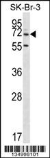 ZNF398 Antibody