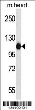 ACTN2 Antibody