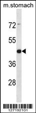 ARRDC1 Antibody