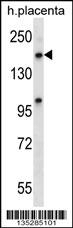 XPO5 Antibody