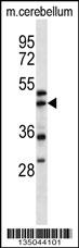 ACTR1A Antibody