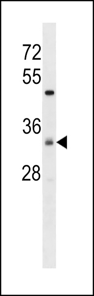 ZDHC7 Antibody
