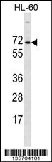 ACPL2 Antibody