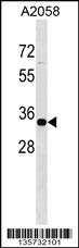 ZNF570 Antibody