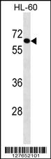 AIM1L Antibody
