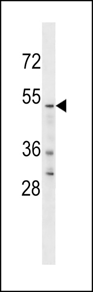 YTHD2 Antibody