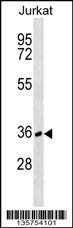 CD226 Antibody