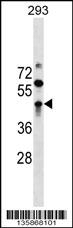 ZBTB32 Antibody