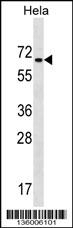 ZNF35 Antibody